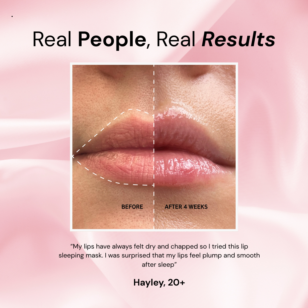 adoura™ Lip Sleeping Mask
