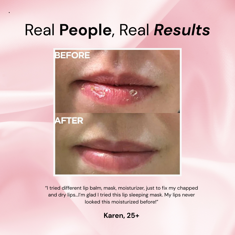 adoura™ Lip Sleeping Mask