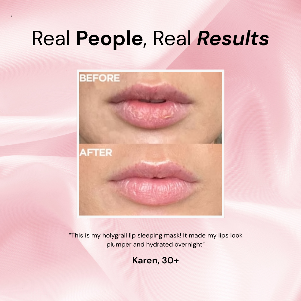 adoura™ Lip Sleeping Mask