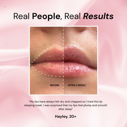 adoura™ Lip Sleeping Mask