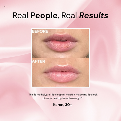 adoura™ Lip Sleeping Mask